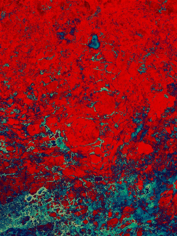 ABM00036