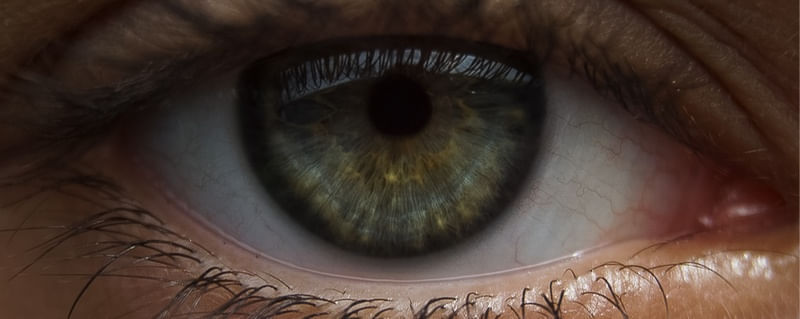HETEROCROMIA CENTRAL