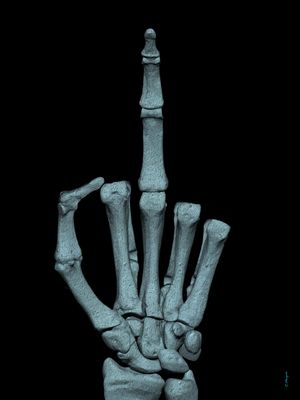 FUCK SKULL