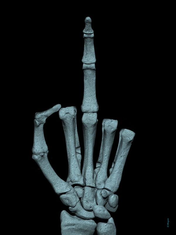 FUCK SKULL