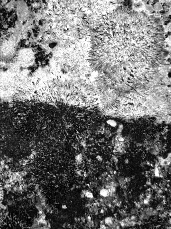 RADIOGRAFIAS DAS MONTANHAS