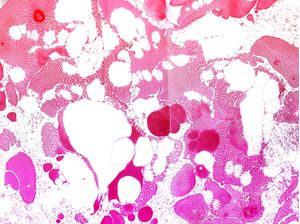 MARBLED MIRACLE