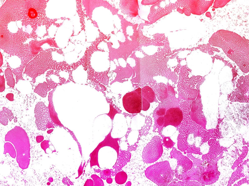 MARBLED MIRACLE