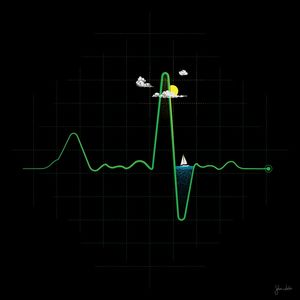 LIVING ON A HEARTBEAT