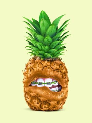 PINEAPPLE BRACES