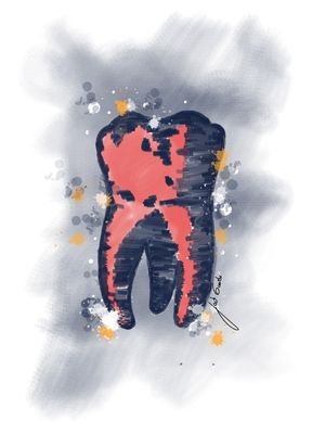TOOTH 3/3